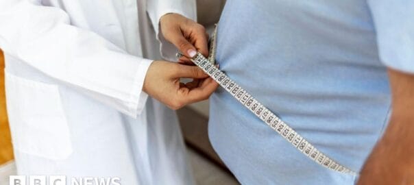 NHS needs better plan around weight loss jabs, warn experts