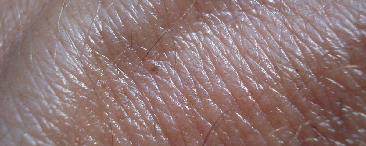 The Biomechanics of Dermal Fillers