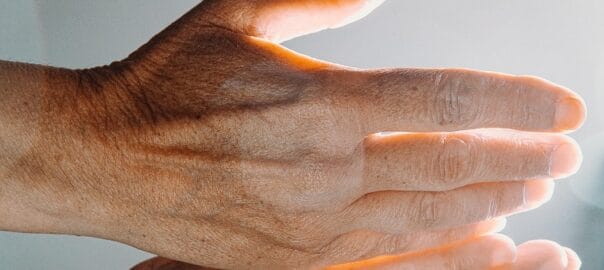 The Best Treatments for Enlarged Pores